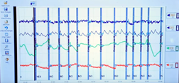 lease a polygraph for YouTube